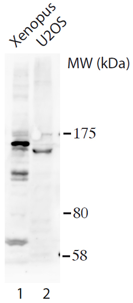 Western blot - Anti-RFC1 antibody (AB193559), expandable thumbnail