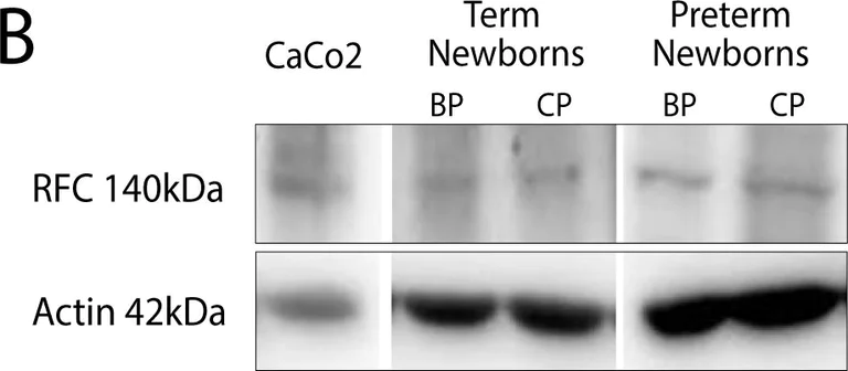 Western blot - Anti-RFC1 antibody (AB3853)