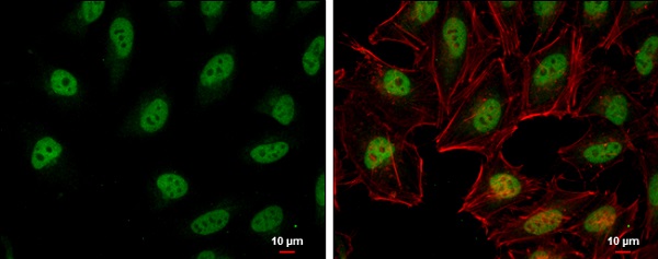 Immunocytochemistry/ Immunofluorescence - Anti-RFC1 antibody - C-terminal (AB229229), expandable thumbnail