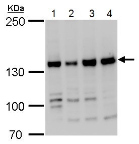 Western blot - Anti-RFC1 antibody - C-terminal (AB229229), expandable thumbnail