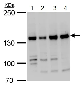 Western blot - Anti-RFC1 antibody - C-terminal (AB229229)