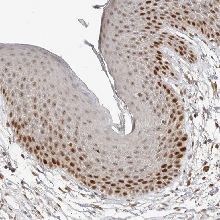 Immunohistochemistry (Formalin/PFA-fixed paraffin-embedded sections) - Anti-RFC2 antibody (AB251796)