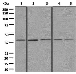 Western blot - Anti-RFC2 antibody [EPR12093(B)] (AB174271)