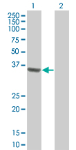 Western blot - RFC2 overexpression 293T lysate (whole cell) (AB94285)