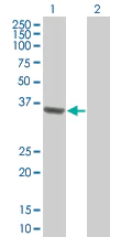 Western blot - RFC2 overexpression 293T lysate (whole cell) (AB94285)
