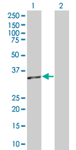 Western blot - RFC2 overexpression 293T lysate (whole cell) (AB94286)