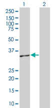 Western blot - RFC2 overexpression 293T lysate (whole cell) (AB94286)