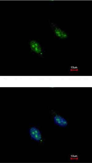 Immunocytochemistry/ Immunofluorescence - Anti-RFC3 antibody (AB154899), expandable thumbnail