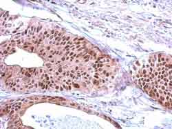 Immunohistochemistry (Formalin/PFA-fixed paraffin-embedded sections) - Anti-RFC3 antibody (AB154899), expandable thumbnail