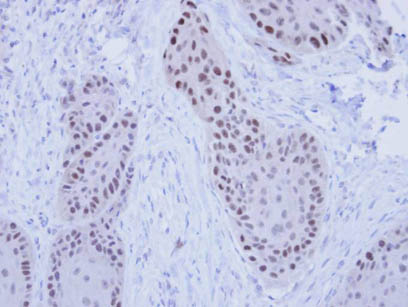 Immunohistochemistry (Formalin/PFA-fixed paraffin-embedded sections) - Anti-RFC4 antibody (AB96852), expandable thumbnail