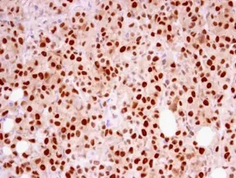 Immunohistochemistry (Formalin/PFA-fixed paraffin-embedded sections) - Anti-RFC4 antibody (AB96852)