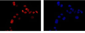 Immunocytochemistry/ Immunofluorescence - Anti-RFC4 antibody [EPR14556] (AB182145), expandable thumbnail