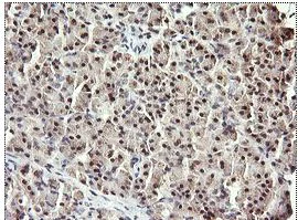 Immunohistochemistry (Formalin/PFA-fixed paraffin-embedded sections) - Anti-RFC4 antibody [OTI1A8] (AB156780)