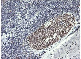 Immunohistochemistry (Formalin/PFA-fixed paraffin-embedded sections) - Anti-RFC4 antibody [OTI1A8] (AB156780)
