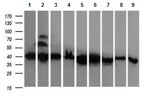 Western blot - Anti-RFC4 antibody [OTI1A8] (AB156780), expandable thumbnail