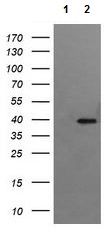 Western blot - Anti-RFC4 antibody [OTI1A8] (AB156780), expandable thumbnail