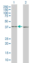 Western blot - RFC4 overexpression 293T lysate (whole cell) (AB94287)