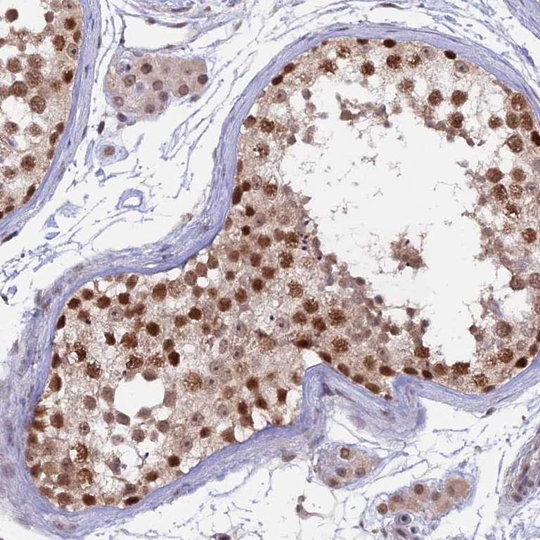 Immunohistochemistry (Formalin/PFA-fixed paraffin-embedded sections) - Anti-RFC5 antibody (AB254853)
