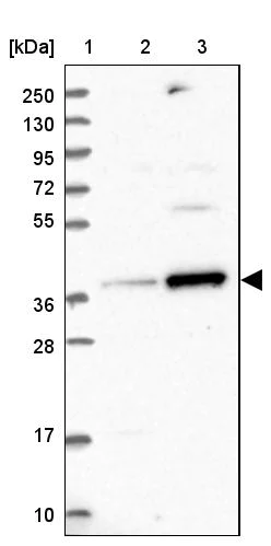 Western blot - Anti-RFC5 antibody (AB254853)
