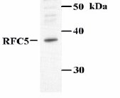 Western blot - Anti-RFC5 antibody (AB3619), expandable thumbnail