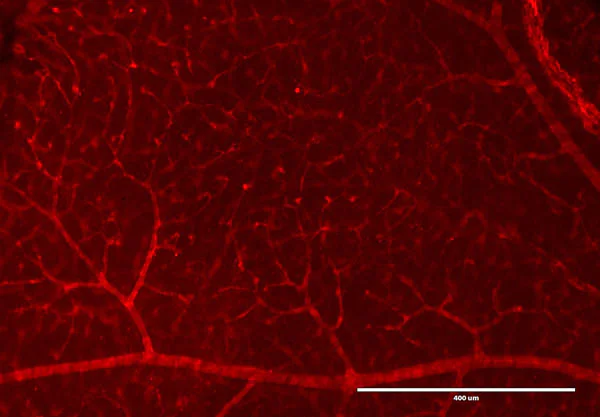 Immunohistochemistry (Formalin/PFA-fixed paraffin-embedded sections) - Anti-RFP antibody (AB124754)