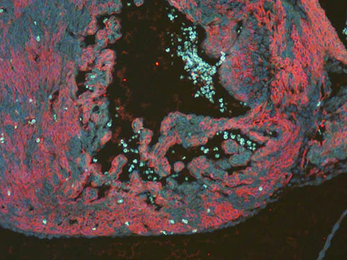 Immunohistochemistry (Formalin/PFA-fixed paraffin-embedded sections) - Anti-RFP antibody (AB124754)