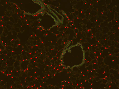 Immunohistochemistry (Formalin/PFA-fixed paraffin-embedded sections) - Anti-RFP antibody (AB124754)