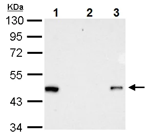 Immunoprecipitation - Anti-RFP antibody (AB152123)