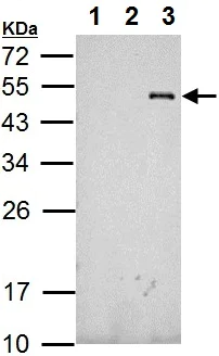 Western blot - Anti-RFP antibody (AB152123)