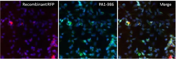 Immunocytochemistry/ Immunofluorescence - Anti-RFP antibody (AB28664)