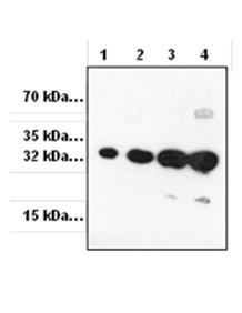 Western blot - Anti-RFP antibody (AB62341), expandable thumbnail
