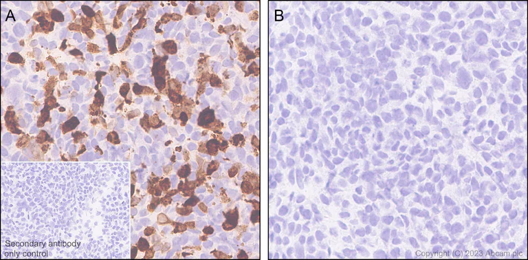 Immunohistochemistry (Formalin/PFA-fixed paraffin-embedded sections) - Anti-RFP antibody [EPR28246-45] - BSA and Azide free (AB314226)