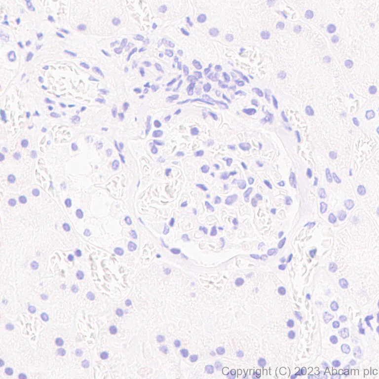 Immunohistochemistry (Formalin/PFA-fixed paraffin-embedded sections) - Anti-RFP antibody [EPR28246-45] - BSA and Azide free (AB314226)