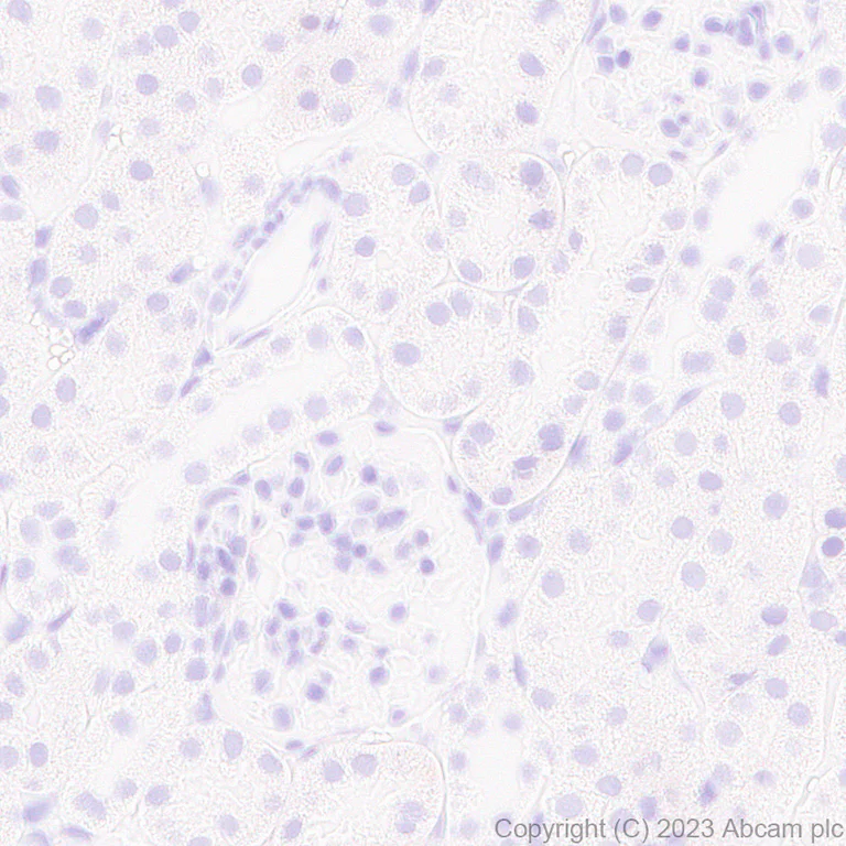 Immunohistochemistry (Formalin/PFA-fixed paraffin-embedded sections) - Anti-RFP antibody [EPR28246-45] - BSA and Azide free (AB314226)