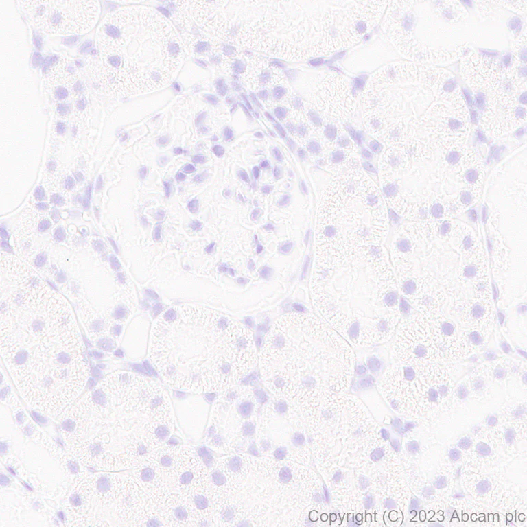 Immunohistochemistry (Formalin/PFA-fixed paraffin-embedded sections) - Anti-RFP antibody [EPR28246-45] - BSA and Azide free (AB314226)