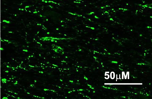 Immunohistochemistry (Frozen sections) - Anti-RFRP antibody (AB228496)