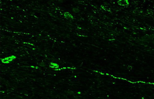 Immunohistochemistry (Frozen sections) - Anti-RFRP antibody (AB228496), expandable thumbnail