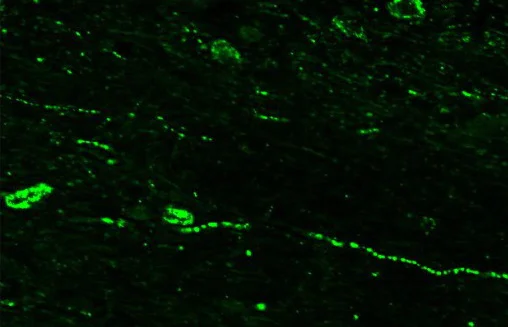 Immunohistochemistry (Frozen sections) - Anti-RFRP antibody (AB228496)