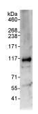 Immunoprecipitation - Anti-RFWD3 antibody (AB99306), expandable thumbnail