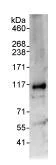 Immunoprecipitation - Anti-RFWD3 antibody (AB99306)