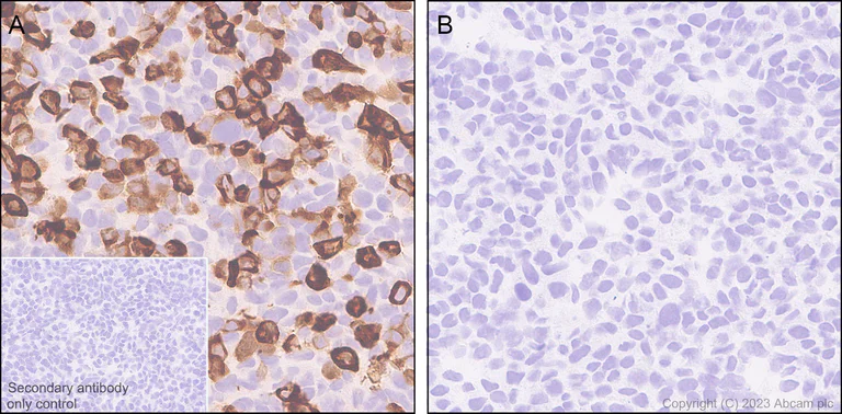 Immunohistochemistry (Formalin/PFA-fixed paraffin-embedded sections) - Anti-Rfx Cas13d (N-term) antibody [EPR23965-31] - BSA and Azide free (AB314742)