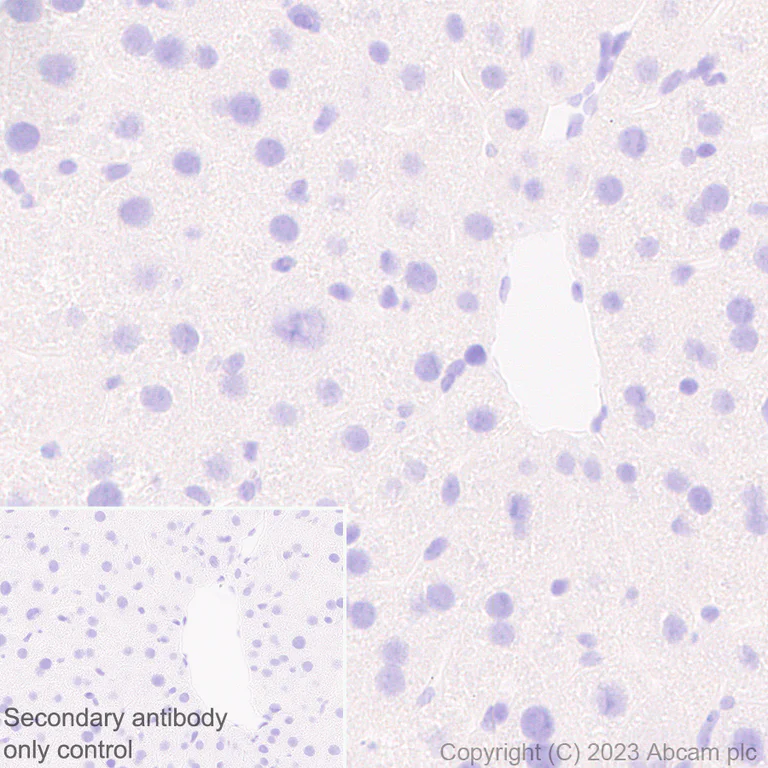 Immunohistochemistry (Formalin/PFA-fixed paraffin-embedded sections) - Anti-Rfx Cas13d (N-term) antibody [EPR23965-31] - BSA and Azide free (AB314742)