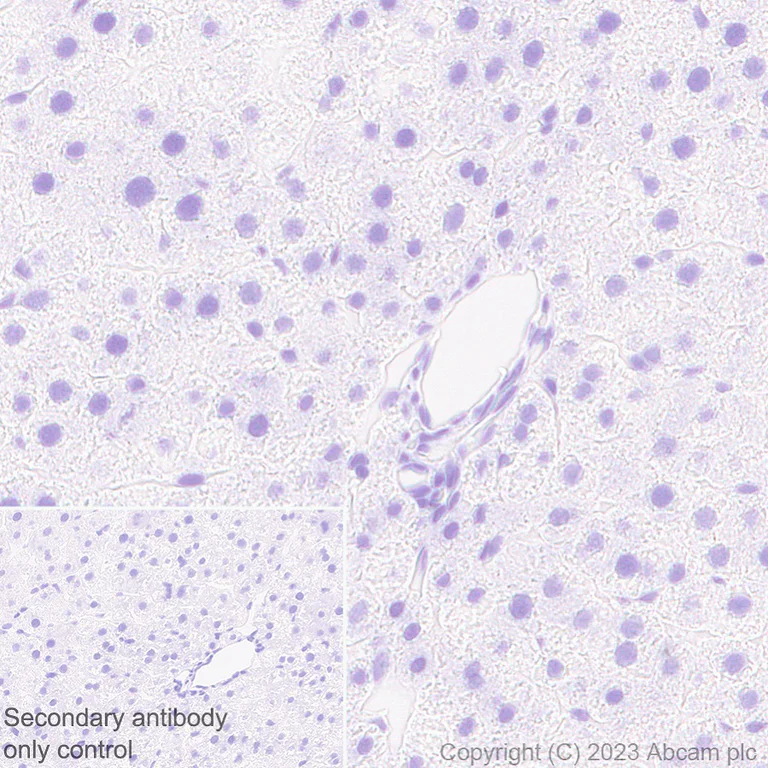 Immunohistochemistry (Formalin/PFA-fixed paraffin-embedded sections) - Anti-Rfx Cas13d (N-term) antibody [EPR23965-31] - BSA and Azide free (AB314742)