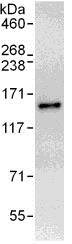 Immunoprecipitation - Anti-RFX1 antibody (AB110927)