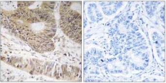 Immunohistochemistry (Formalin/PFA-fixed paraffin-embedded sections) - Anti-RFX3 antibody (AB92670)