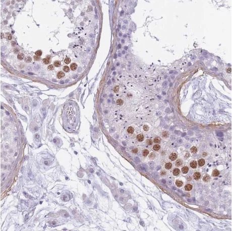 Immunohistochemistry (Formalin/PFA-fixed paraffin-embedded sections) - Anti-RFX4 antibody (AB188020)