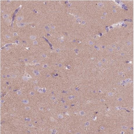 Immunohistochemistry (Formalin/PFA-fixed paraffin-embedded sections) - Anti-RFX4 antibody (AB188020), expandable thumbnail
