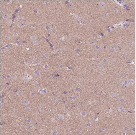 Immunohistochemistry (Formalin/PFA-fixed paraffin-embedded sections) - Anti-RFX4 antibody (AB188020)