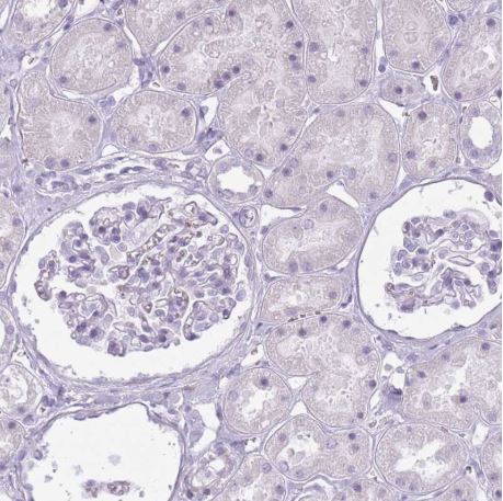 Immunohistochemistry (Formalin/PFA-fixed paraffin-embedded sections) - Anti-RFX4 antibody (AB188020), expandable thumbnail
