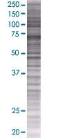 SDS-PAGE - RFX5 overexpression 293T lysate (whole cell) (AB94108)